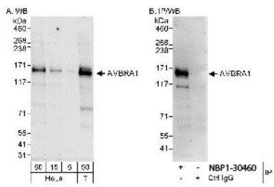 Western Blot: AMBRA1 Antibody [NBP1-30460] - Whole cell lysate from HeLa (5, 15 and 50 ug for WB; 1 mg for IP, 20% of IP loaded) and 293T (T; 50 ug) cells. Antibodies: Affinity purified rabbit anti-AMBRA1 antibody used for WB at 0.04 ug/ml (A) and 1 ug/ml (B) and used for IP at 3 ug/mglysate. Detection: Chemiluminescence with exposure times of 30 seconds (A and B).