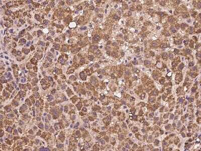 Immunohistochemistry-Paraffin: AMD1 Antibody [NBP2-97180] - Immunochemical staining of human AMD1 in human liver with rabbit polyclonal antibody at 1:100 dilution, formalin-fixed paraffin embedded sections.