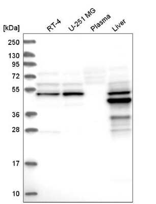 Western Blot: AMDHD1 Antibody [NBP1-82701] - Analysis in human cell line RT-4, human cell line U-251 MG, human plasma and human liver tissue.