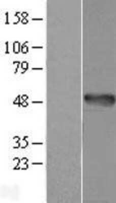 Western Blot: AMDHD1 Overexpression Lysate (Adult Normal) [NBL1-07497] Left-Empty vector transfected control cell lysate (HEK293 cell lysate); Right -Over-expression Lysate for AMDHD1.