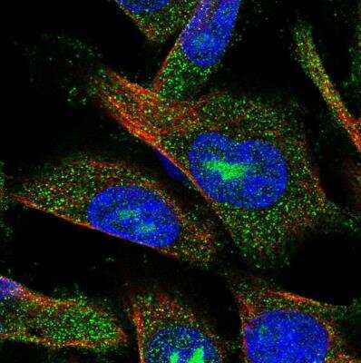 <b>Independent Antibodies Validation. </b>Immunocytochemistry/Immunofluorescence: AMDHD2 Antibody [NBP1-84516] -  Staining of human cell line U-251 MG shows localization to nucleoli & cytosol. Antibody staining is shown in green.