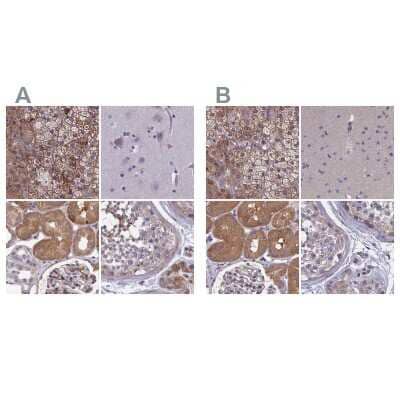 Immunohistochemistry-Paraffin AMDHD2 Antibody - BSA Free
