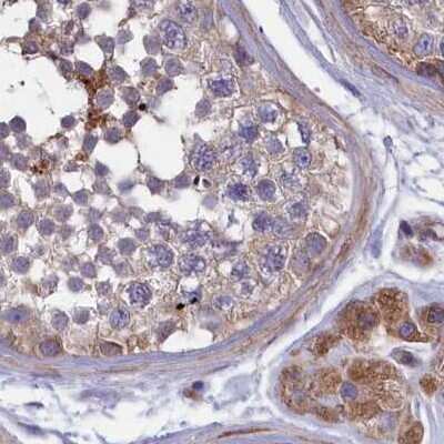 Immunohistochemistry-Paraffin: AMDHD2 Antibody [NBP1-84516] - Staining of human testis.