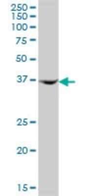 Western Blot AMDHD2 Antibody - Azide and BSA Free