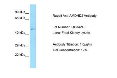 Western Blot: AMDHD2 Antibody [NBP2-86991] - Host: Rabbit. Target Name: AMDHD2. Sample Type: Fetal Kidney. Antibody Dilution: 1.0ug/ml