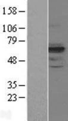 Western Blot MIS RII/AMHR2 Overexpression Lysate