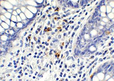 Immunohistochemistry-Paraffin: AMID Antibody - BSA Free [NBP3-18132] - Immunohistochemical analysis of paraffin-embedded human testis tissue using anti-AMID antibody (NBP3-18132) at 1 ug/mL. Tissue was fixed with formaldehyde and blocked with 10% serum for 1 h at RT; antigen retrieval was by heat mediation with a citrate buffer (pH6). Samples were incubated with primary antibody overnight at 4C. A goat anti-rabbit IgG H&L (HRP) at 1/250 was used as secondary. Counter stained with Hematoxylin.