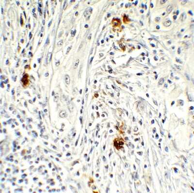 Immunohistochemistry-Paraffin: AMID Antibody - BSA Free [NBP3-18133] - Immunohistochemical analysis of paraffin-embedded human brain tissue using anti-AMID antibody (NBP3-18133) at 1 ug/mL. Tissue was fixed with formaldehyde and blocked with 10% serum for 1 h at RT; antigen retrieval was by heat mediation with a citrate buffer (pH6). Samples were incubated with primary antibody overnight at 4C. A goat anti-rabbit IgG H&L (HRP) at 1/250 was used as secondary. Counter stained with Hematoxylin.