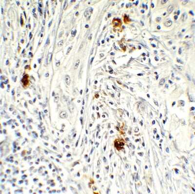 Immunohistochemistry-Paraffin: AMID Antibody - BSA Free [NBP3-18133] - Immunohistochemical analysis of paraffin-embedded human brain tissue using anti-AMID antibody (NBP3-18133) at 1 ug/mL. Tissue was fixed with formaldehyde and blocked with 10% serum for 1 h at RT; antigen retrieval was by heat mediation with a citrate buffer (pH6). Samples were incubated with primary antibody overnight at 4C. A goat anti-rabbit IgG H&L (HRP) at 1/250 was used as secondary. Counter stained with Hematoxylin.