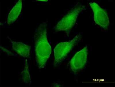 Immunocytochemistry/Immunofluorescence: AMID Antibody [H00084883-B01P] - Analysis of purified antibody to AMID on HeLa cell. (antibody concentration 10 ug/ml)