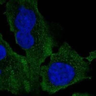 Immunocytochemistry/Immunofluorescence: AMID Antibody [NBP3-17800] - Staining of human cell line U-2 OS shows localization to plasma membrane & vesicles.