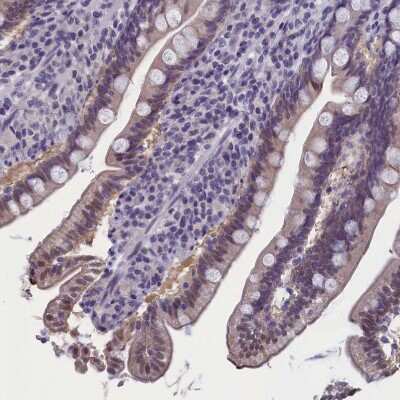 Immunohistochemistry-Paraffin: AMID Antibody [NBP1-90176] - Staining of human small intestine shows weak cytoplasmic and membranous positivity in glandular cells.