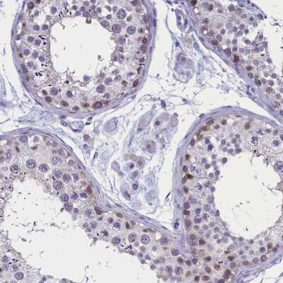 Immunohistochemistry-Paraffin: AMID Antibody [NBP1-90176] - Staining of human testis shows weak cytoplasmic and nuclear positivity in a subset of cells in seminiferous ducts.