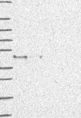 Western Blot: AMID Antibody [NBP3-17800] - Lane 1: Marker [kDa] 250, 130, 95, 72, 55, 36, 28, 17, 10;   Lane 2: RT4;   Lane 3: U-251 MG