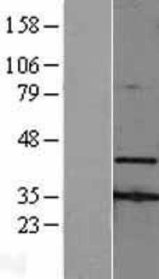 Western Blot AMID Overexpression Lysate