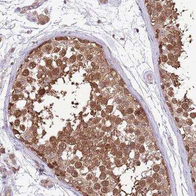 Immunohistochemistry-Paraffin: AMIGO Antibody [NBP2-14287] - Staining of human testis shows strong cytoplasmic and nuclear positivity in cells in seminiferus ducts.