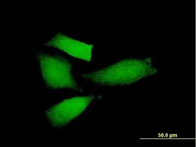 Immunocytochemistry/Immunofluorescence: AMIGO2 Antibody [H00347902-B01P] - Analysis of purified antibody to AMIGO2 on HeLa cell. (antibody concentration 10 ug/ml)