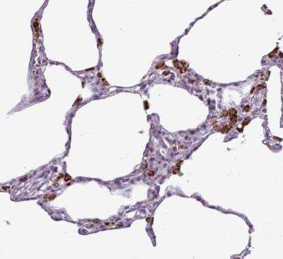 Immunohistochemistry-Paraffin: AMIGO2 Antibody [NBP2-14288] - Staining of human lung shows strong granular cytoplasmic positivity in macrophages.