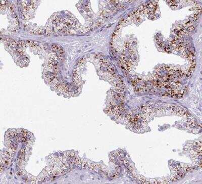 Immunohistochemistry-Paraffin: AMIGO2 Antibody [NBP2-14288] - Staining of human prostate shows strong granular cytoplasmic positivity in glandular cells.