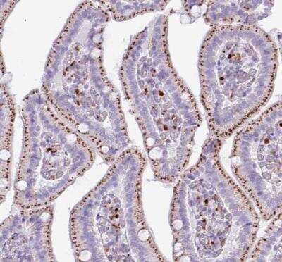 Immunohistochemistry-Paraffin: AMIGO2 Antibody [NBP2-14288] - Staining of human duodenum shows strong granular cytoplasmic positivity in glandular cells.