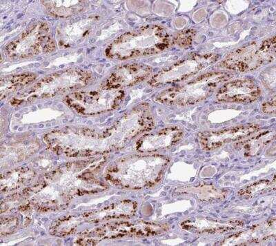 Immunohistochemistry-Paraffin: AMIGO2 Antibody [NBP2-14288] - Staining of human kidney shows strong granular cytoplasmic positivity in cells in tubules.