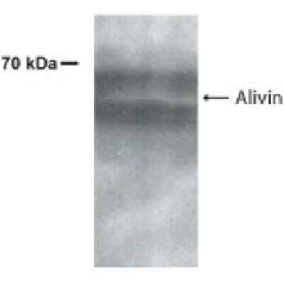 Western Blot: AMIGO2 Antibody [NB300-247] - WB detection of AMIGO2 / Alivin in 50 ug of murine brain lysate using antibody NB300-247 at a dilution of 1:500. This antibody detect bands at 63 kDa and 66 kDa positions in mouse brain tissue.