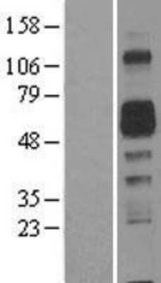 Western Blot AMIGO2 Overexpression Lysate
