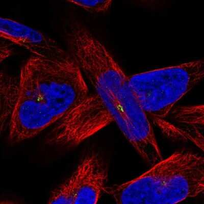 Immunocytochemistry/Immunofluorescence: AMN1 Antibody [NBP2-56554] - Staining of human cell line RH-30 shows localization to centrosome.