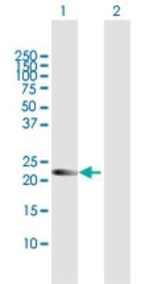 Western Blot: AMN1 Antibody [H00196394-B01P] - Analysis of AMN1 expression in transfected 293T cell line by AMN1 polyclonal antibody.  Lane 1: LOC196394 transfected lysate(23.43 KDa). Lane 2: Non-transfected lysate.