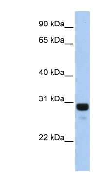 Western Blot: AMN1 Antibody [NBP1-56931] - Human Lung lysate, concentration 0.2-1 ug/ml.