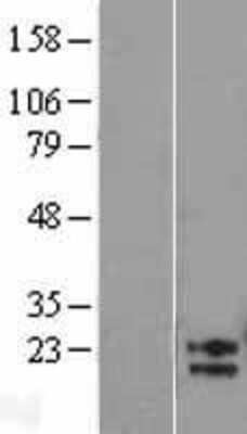 Western Blot: AMN1 Overexpression Lysate (Adult Normal) [NBL1-07504] Left-Empty vector transfected control cell lysate (HEK293 cell lysate); Right -Over-expression Lysate for AMN1.