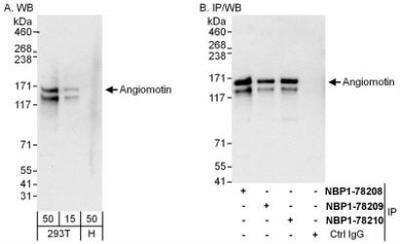 Western Blot: AMOT Antibody [NBP1-78209] - Whole cell lysate from 293T (15 and 50 mcg for WB; 1 mg for IP, 20% of IP loaded) and HeLa (H; 50 mcg) cells.   Affinity purified rabbit anti-Angiomotin antibody  used for WB at 0.04 mcg/ml (A) and 1 mcg/ml (B) and used for IP at 6 mcg/mg lysate.  Angiomotin was also immunoprecipitated by rabbit anti-Angiomotin antibodies NBP1-78208   and NBP1-78210 which recognize other epitopes.