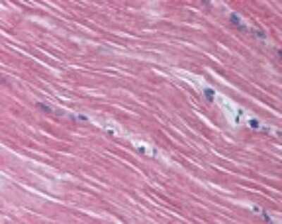 Immunohistochemistry-Paraffin: AMPD1 Antibody [NBP2-24508] - IHC analysis of human skeletal muscle using NBP2-24508 at 10 ug/ml.