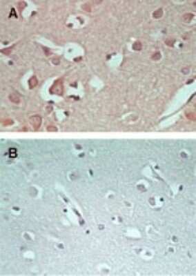 Immunohistochemistry-Paraffin: AMPD1 Antibody [NBP2-24508] - Staining of AMPD1 using this antibody at 5 ug/ml (using control rabbit Ig for figure B).