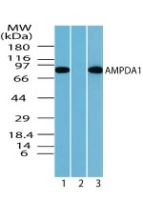 Western Blot: AMPD1 Antibody [NBP2-24508] - Analysis of AMPDA1 in rat skeletal muscle lysate in the 1) absence, 2) presence of immunizing peptide and 3) mouse skeletal muscle using this antibody. 5 ug/ml.