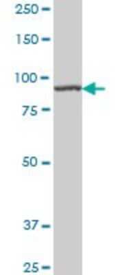 Western Blot: AMPD2 Antibody (2F5) [H00000271-M01A] - AMPD2 monoclonal antibody (M01A), clone 2F5 Analysis of AMPD2 expression in Hela S3 NE.
