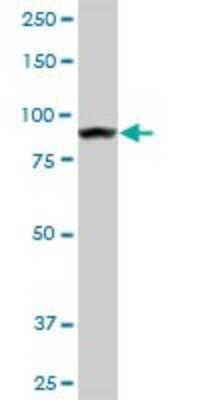Western Blot: AMPD2 Antibody (2F5) [H00000271-M01A] - AMPD2 monoclonal antibody (M01A), clone 2F5. Analysis of AMPD2 expression in Raw 264.7.