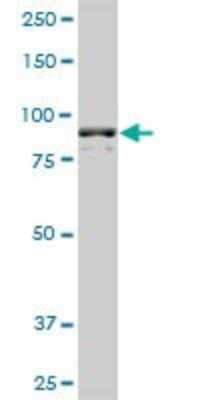 Western Blot: AMPD2 Antibody (2F5) [H00000271-M01A] - AMPD2 monoclonal antibody (M01A), clone 2F5. Analysis of AMPD2 expression in NIH/3T3.