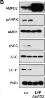 Western Blot: AMPD2 Antibody (2F5) [H00000271-M01A] - Metformin regulates AMPD2 activity in human hepatocytes.Over-expression of AMPD2 down-regulates the activation of AMPK. Transduction of HepG2 cells with lentiviral particles codifying for the isoform 2 of AMPD2 results in significantly higher levels of AMPD2 protein expression as well as AMPD activity. This is paralleled with reduced levels Thr172 pAMPK expression as well as of their target genes ECH1 and Ser79 pACC. *p<0.05. Image collected and cropped by CiteAb from the following publication (www.dx.plos.org/10.1371/journal.pone.0048801) licensed under a CC-BY license.