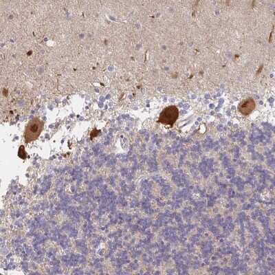 Immunohistochemistry: AMPD2 Antibody [NBP2-48578] - Staining of human cerebellum shows strong cytoplasmic and nuclear positivity in Purkinje cells.