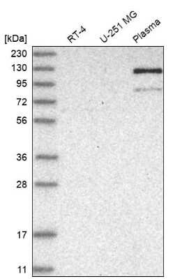 Western Blot: AMPD2 Antibody [NBP2-48578] - Analysis in human cell line RT-4, human cell line U-251 MG and human plasma.