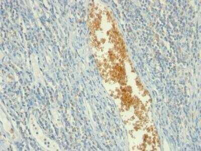 Immunohistochemistry-Paraffin: AMPD3 Antibody (AMPD3/901) - Azide and BSA Free [NBP2-47691] - Human Tonsil stained with AMPD3 Monoclonal Antibody (AMPD3/901)