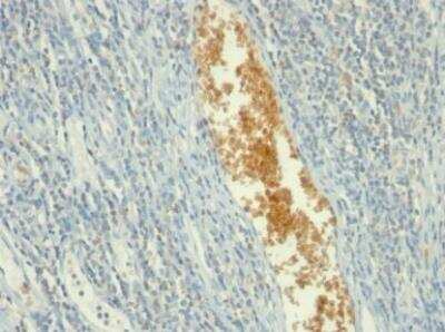 Immunohistochemistry-Paraffin: AMPD3 Antibody (AMPD3/901) - IHC-Prediluted [NBP2-48158] - Formalin-fixed, paraffin-embedded human Tonsil stained with AMPD3 Mouse Monoclonal Antibody (AMPD3/901)
