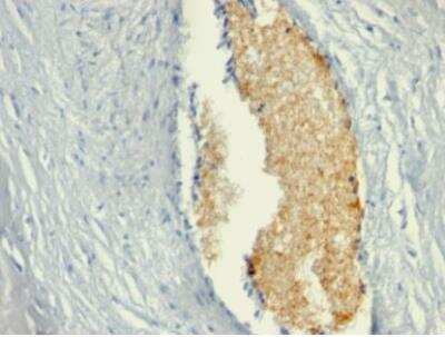 Immunohistochemistry-Paraffin: AMPD3 Antibody (AMPD3/901) - IHC-Prediluted [NBP2-48158] - Formalin-fixed, paraffin-embedded human Placenta stained with AMPD3 Mouse Monoclonal Antibody (AMPD3/901)