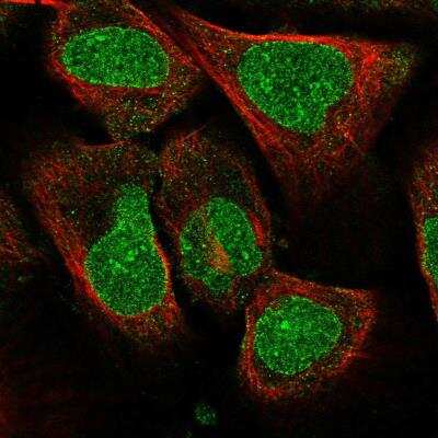 Immunocytochemistry/Immunofluorescence: AMPD3 Antibody [NBP2-14290] - Immunofluorescent staining of human cell line U-2 OS shows localization to nucleoli &amp; nuclear membrane. Antibody staining is shown in green.