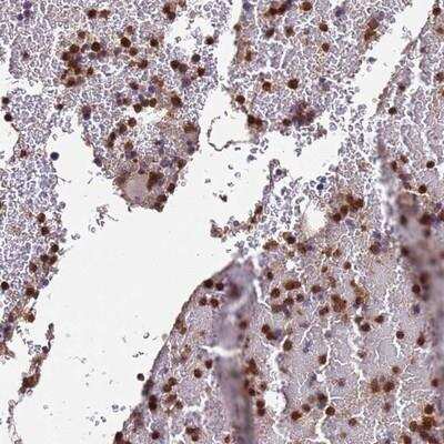 Immunohistochemistry-Paraffin: AMPD3 Antibody [NBP2-14290] - Staining of human bone marrow shows strong cytoplasmic positivity in hematopoietic cells.