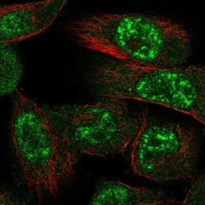 Immunocytochemistry/Immunofluorescence: AMPK alpha 1 Antibody [NBP2-58302] - Staining of human cell line U-251 MG shows localization to nuclear speckles.