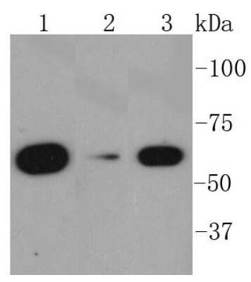 Western Blot: AMPK alpha 1 Antibody (SU03-48) [NBP2-67472] - Analysis of AMPK alpha 1 on different lysates using anti-AMPK alpha 1 antibody at 1/1,000 dilution. Positive control: Lane 1: Hela Lane 2: HepG2 Lane 3: MCF-7