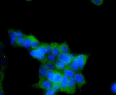 Immunocytochemistry/Immunofluorescence: AMPK alpha 1 [p Ser496] Antibody (SD0810) [NBP2-67805] - Staining Phospho-AMPK alpha 1(S496) in 293T cells (green). The nuclear counter stain is DAPI (blue). Cells were fixed in paraformaldehyde, permeabilised with 0.25% Triton X100/PBS.