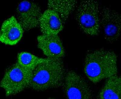 Immunocytochemistry/Immunofluorescence: AMPK alpha 1 [p Ser496] Antibody (SD0810) [NBP2-67805] - Staining Phospho-AMPK alpha 1(S496) in A549 cells (green). The nuclear counter stain is DAPI (blue). Cells were fixed in paraformaldehyde, permeabilised with 0.25% Triton X100/PBS.